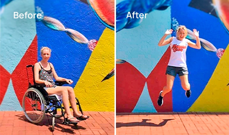 fibromyalgia healing remission spero clinic before and after