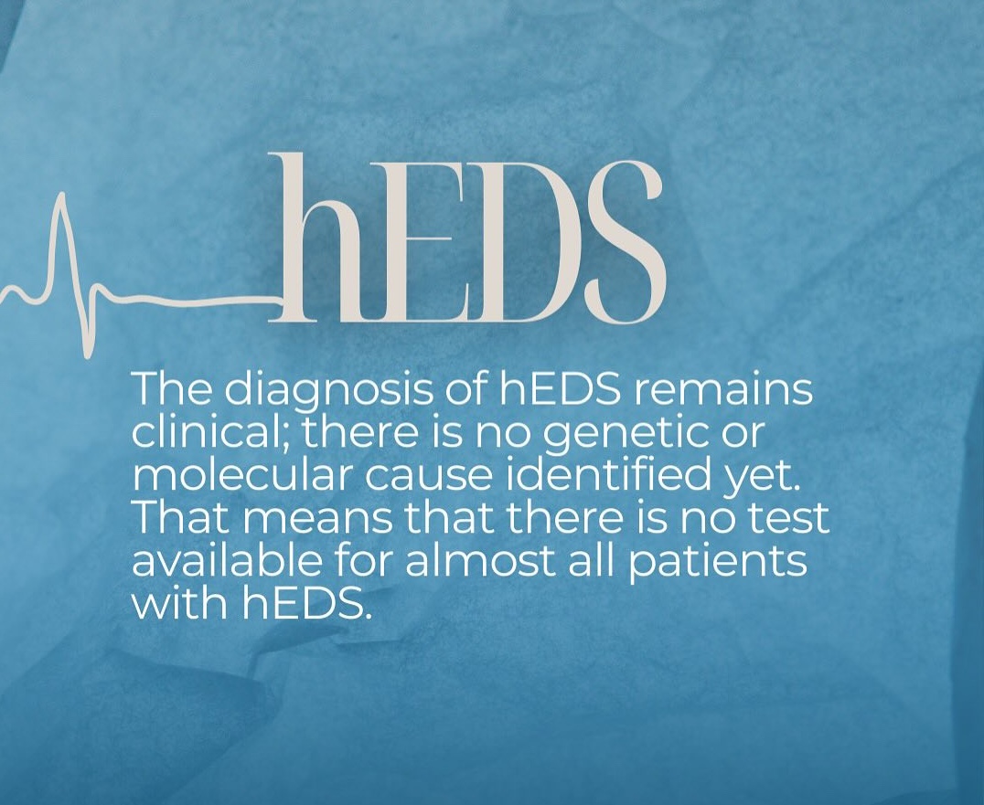 heds hypermobile ehlers danlos syndrome diagnosis