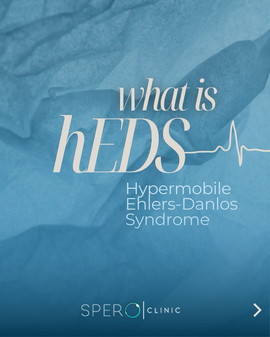 Hypermobile EDS (hEDS) Effective Treatments