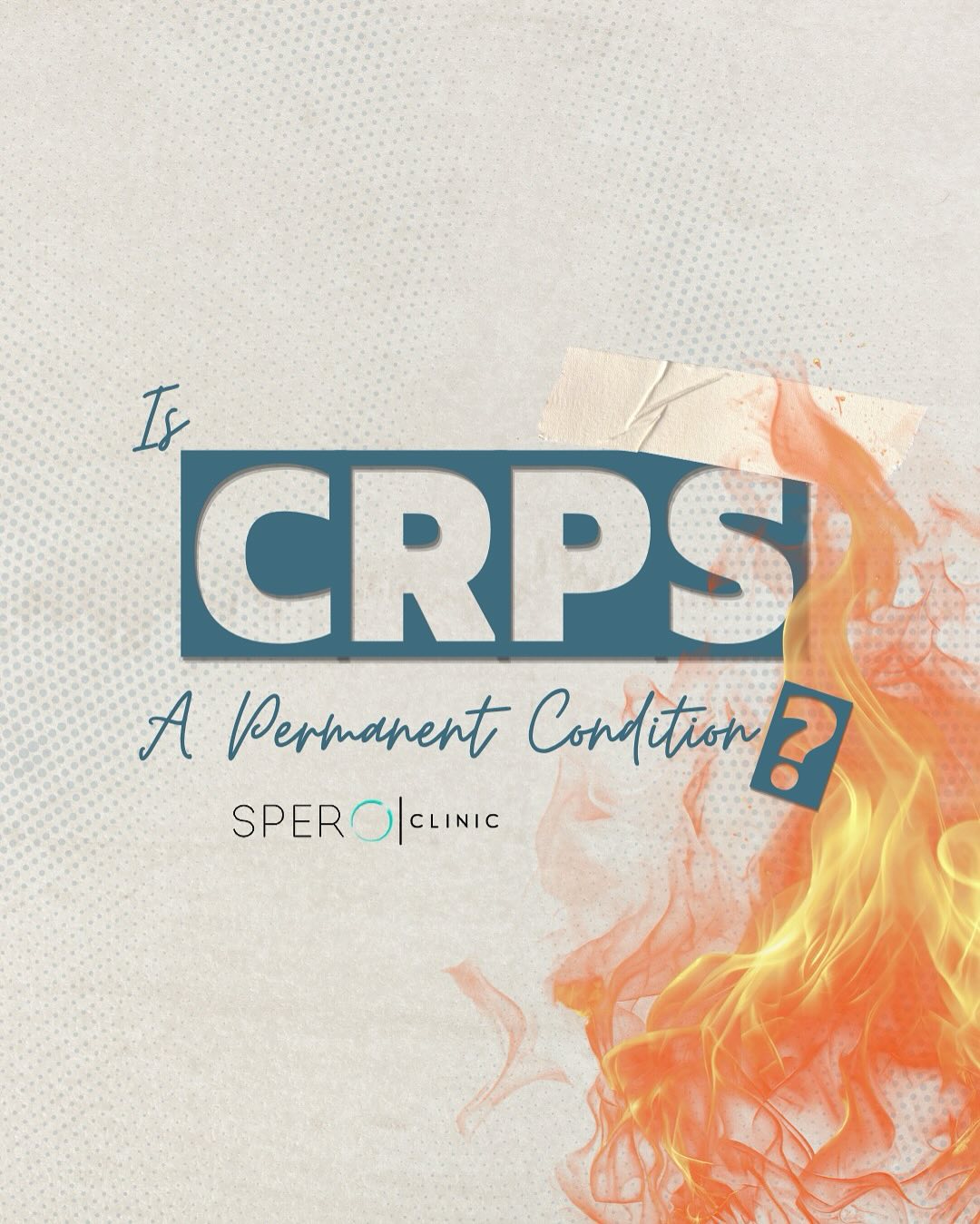 is crps a permanent condition